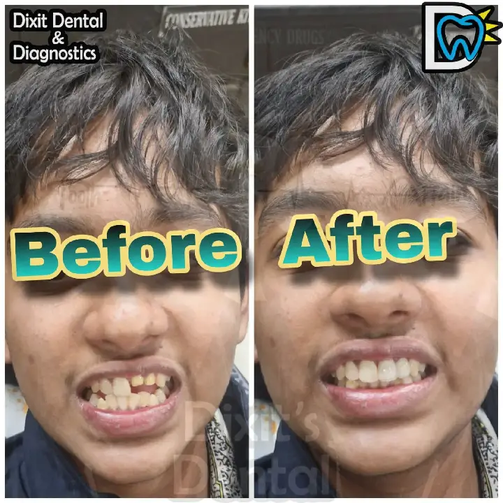 Before and after